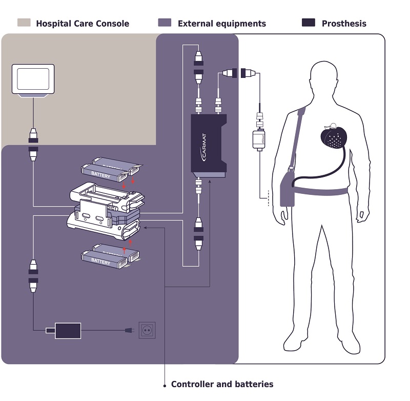 diagram of Carmat Aeson heart components