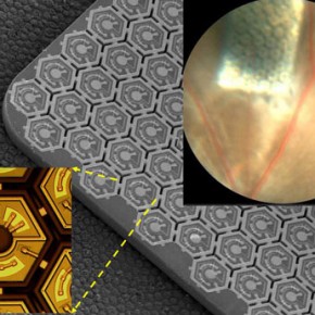 Retina Prosthesis